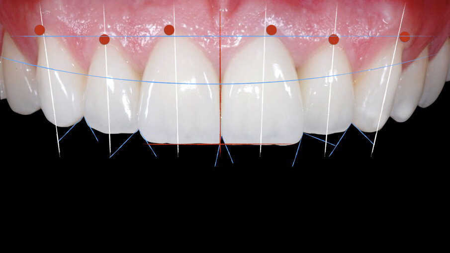 Fig. 1_Composizione estetica anteriore ideale.