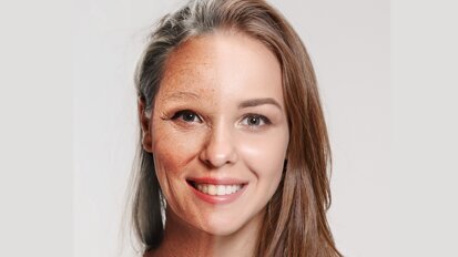 ¿Se puede revertir el envejecimiento? (1)