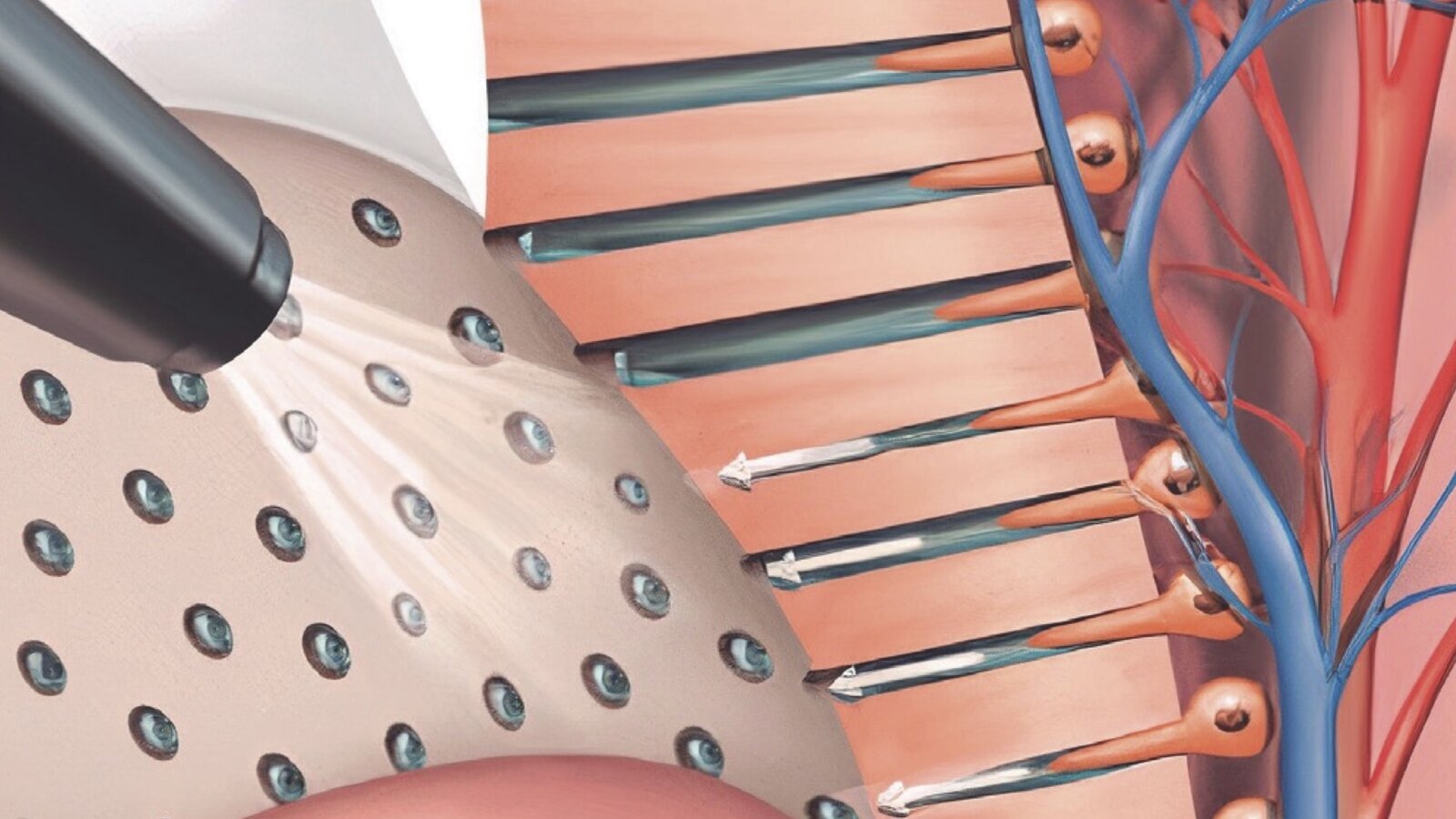 Estética y blanqueamiento dental en la era digital  (Capítulo 11)