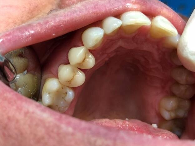 Fig. 8: Final result from below