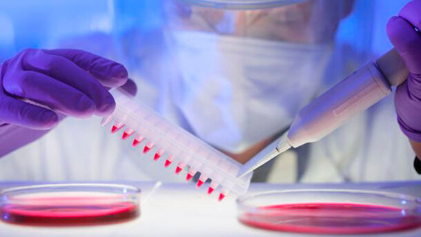 Ricercatori del dentale impegnati a perfezionare il test dell’HIV nei Paesi in via di sviluppo