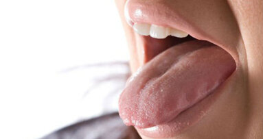 La sensibilità all’amaro può rivelare quale sarà l'esito chirurgico in pazienti affetti da sinusite