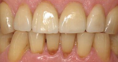 En busca de la sonrisa perdida (1)