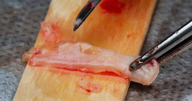 Perio Master Clinic 2022 conference to be held in Mexico