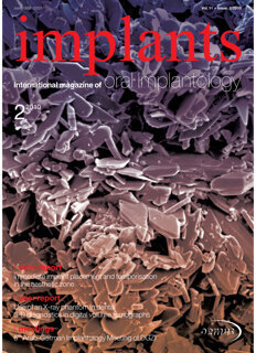 implants international implants international