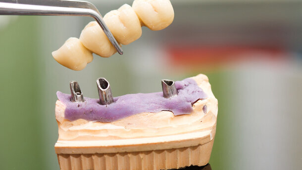 Neue Gütesiegel für zahntechnische Erzeugnisse