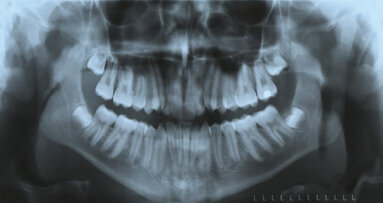 The age of digital imaging (Part 1)