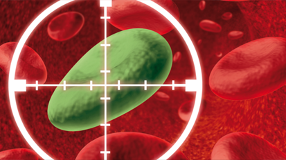 Gutartiges Bakterium A12 bekämpft Karies Gutartiges Bakterium A12 bekämpft Karies