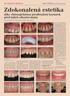 DT Czech and Slovak Republic