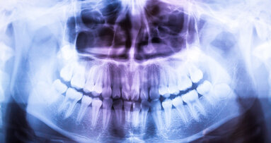 Tandarts die per röntgenfoto betaald krijgt, maakt er meer