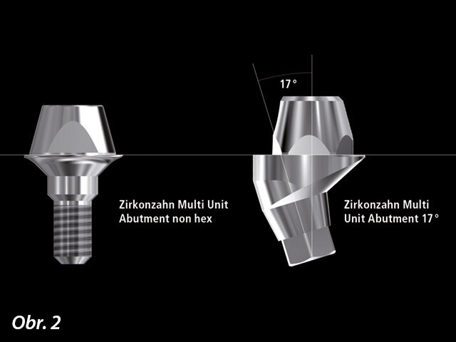 Multi Unit Abutments rovné a angulované (17 °) jsou vynikající pro složité rekonstrukce zubních oblouků, kde jsou disparalelně zavedené implantáty (tzn. rozbíhavé kanály pro šroubky). Lze je využít pro všechny typy náhrad kotvených implantáty.