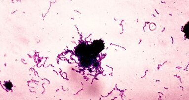 Кариесогенна бактерия може да допринася за разграждането на композиционните материали