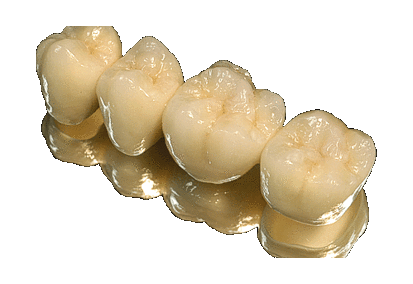 Είναι αποδοτική η τεχνολογία CAD/CAM;