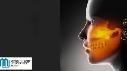 Faktor für schmerzhafte Gelenksabnützung entdeckt Faktor für schmerzhafte Gelenksabnützung entdeckt