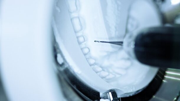 Les derniers développements dans le secteur européen des dispositifs CFAO