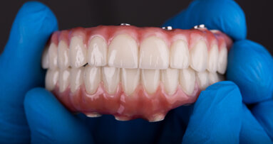 “Most scanning errors are not caused by poor technology but by a lack of controlled geometry”