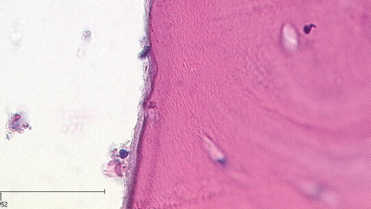 Laser in chirurgia orale e medicina