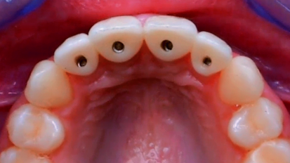 NobelClinician is the key to successful treatment outcomes