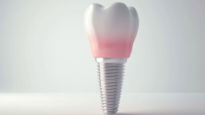 Neue S3-Leitlinie zum Thema Keramikimplantate