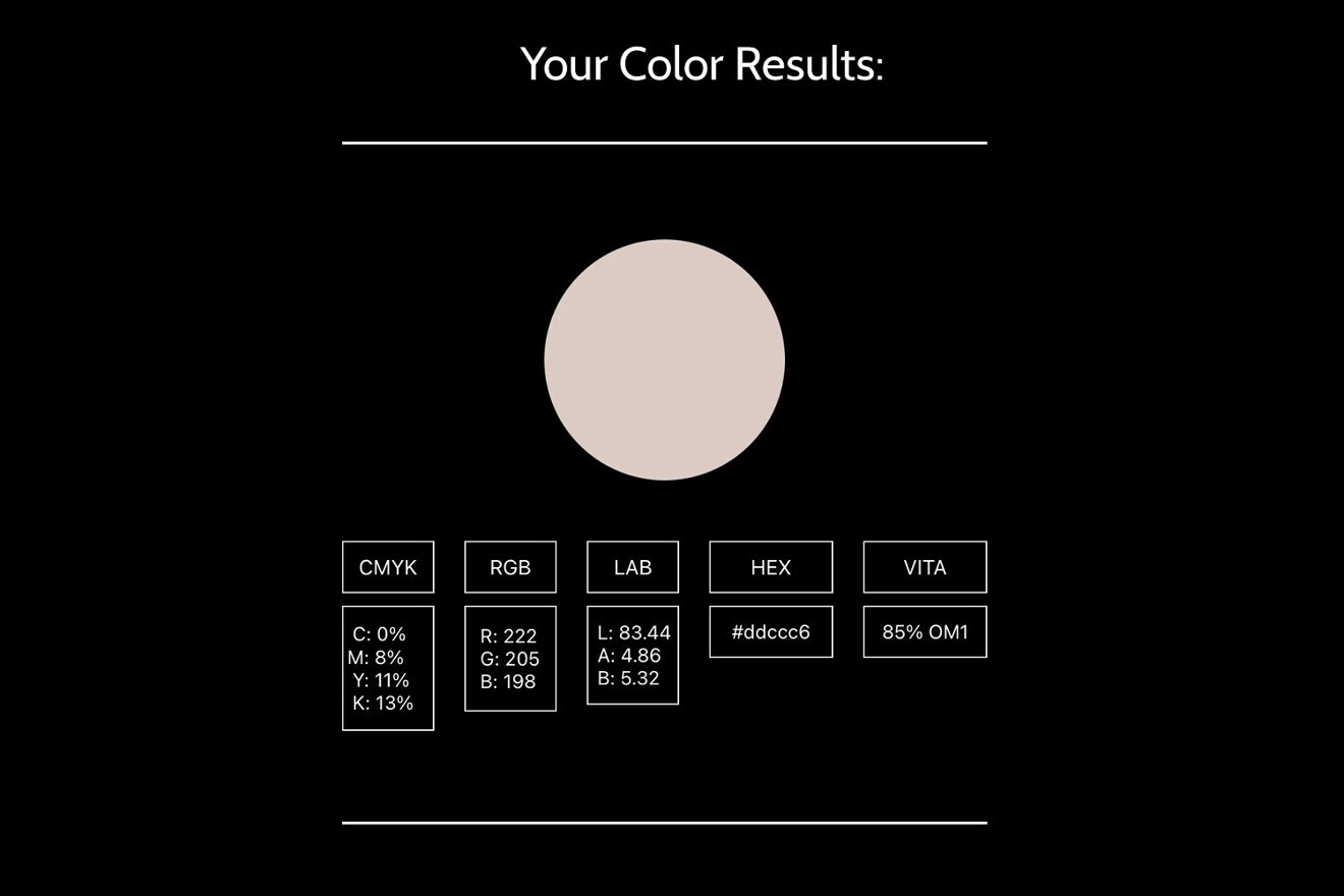 Fig. 17: 3D-printed crown colour result.