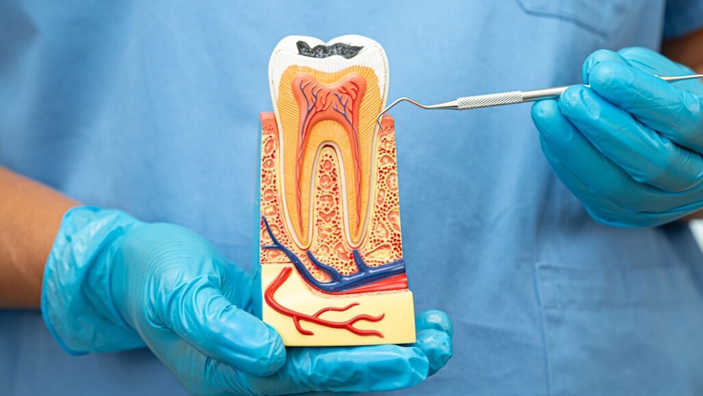 Un nouveau consensus d'experts propose un guide complet sur la microchirurgie apicale