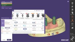 Exocad DentalCAD 3.3 Chemnitz release: Implant Module—enhanced workflow for individual abutments