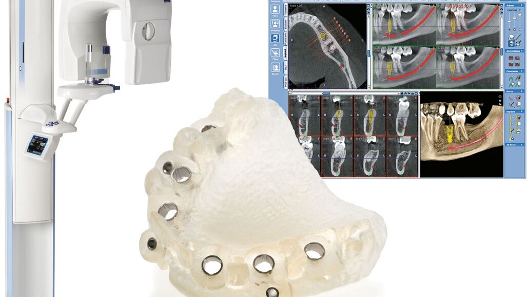 ΑΝΑΚΟΙΝΩΣΗ ΣΥΝΕΡΓΑΣΙΑΣ ΤΩΝ ΕΤΑΙΡΕΙΩΝ PLANMECA ΚΑΙ MATERIALISE DENTAL
