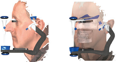 Utilizzo clinico della scansione facciale in ambito odontoiatrico