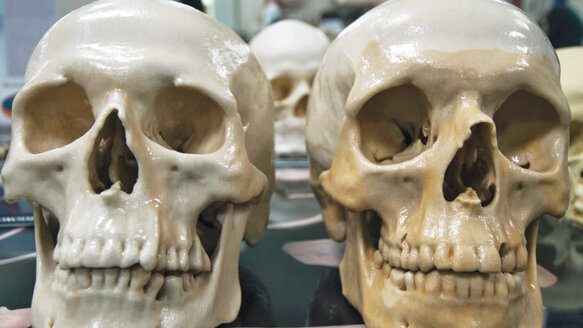 Dental clues assist in effort to identify USS Monitor remains