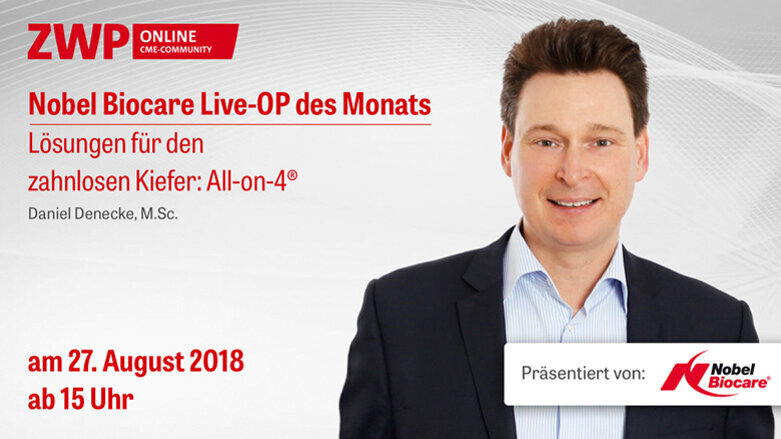 Nobel Biocare Live-OP: Das All-on-4-Behandlungskonzept