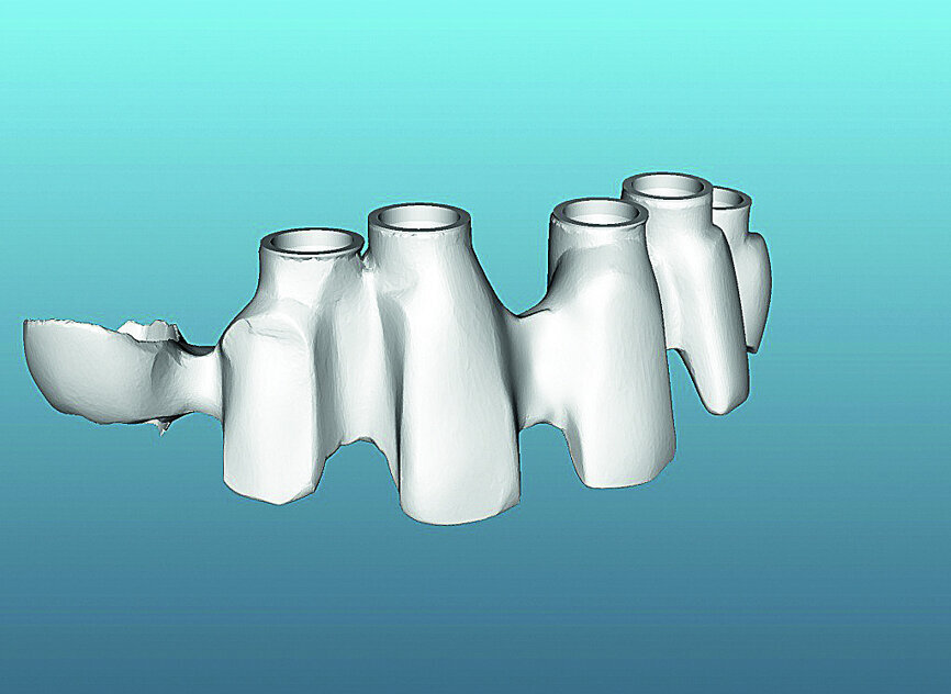 Fig. 24: After scanning, the computer prefi guration of the framework was validated.