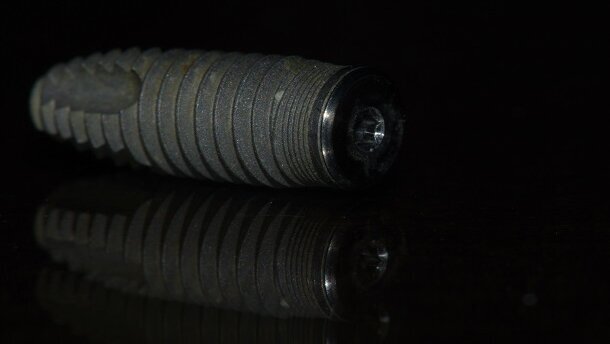 Ultrasonic scaling of titanium implants can trigger Peri-implantitis, indicates latest study