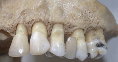 Identifizierung mittels des Gebisses