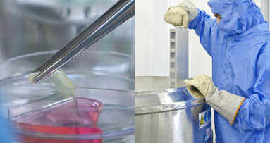 Diferenças entre as células-tronco da polpa do dente de leite e sangue do cordão umbilical