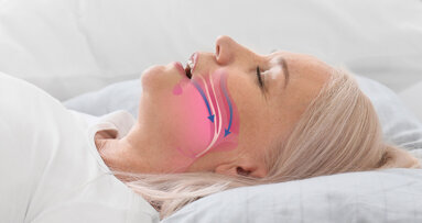 Diagnosi precoce dell’OSAS nella pratica clinica quotidiana: il ruolo dell’igienista dentale