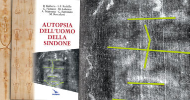 In occasione dell'Ostensione della Sindone, una Autopsia dell’Uomo della Sindone, fatta da 5 medici (tre odontostomatologi)