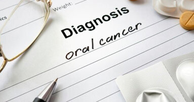 USA: aumentano i casi di cancro orale