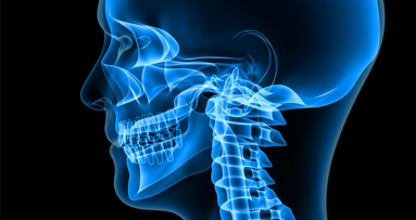 Nach Unfall: Teenager kann Kiefer wieder bewegen