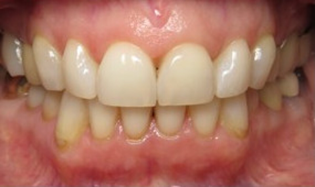Fig. 9f: After. 