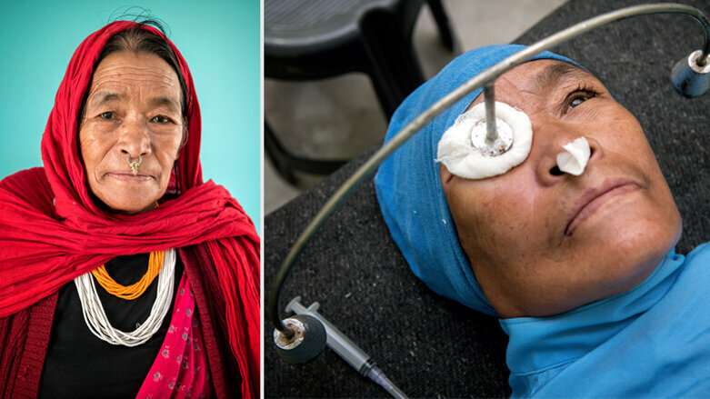 Aktion «Altgold für Augenlicht»: Tagelang wandern, um zu sehen