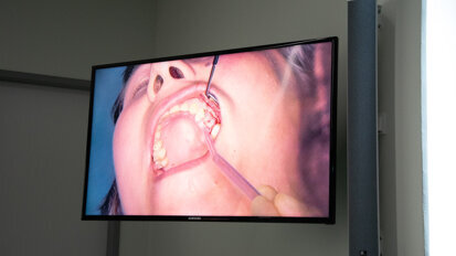 Das durch den Schnitt freigelegte Gewebe näht Wainwright für die Dauer der OP an der Wange fest. Somit würde ein weniger traumatisches Arbeiten ermöglicht und Schwellungen vermieden, erklärt er.