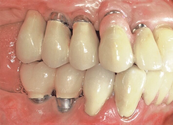 Fig. 5. 2nd consultation. Clinical view (right).