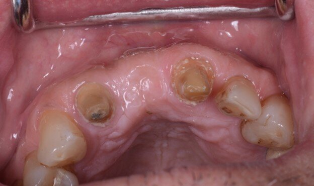 Fig. 14_Situazione pre-operatoria.