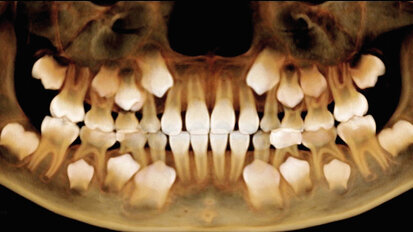 Na téma dentálních digitálních technologií