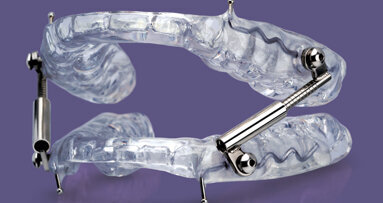 Glidewell Dental introduces a new oral sleep appliance