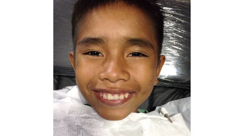 Caso clínico. Figura B. La estética y función de la corona pudieron ser reconstruidas.
