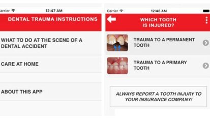 Interview: app voor eerste hulp bij tandletsel