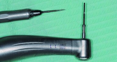 L’implant plutôt que le « dentier » : une réalité incontournable, mais une préparation et des précautions indispensables