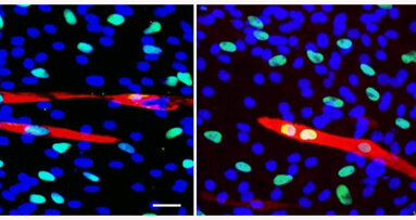 Dentists extract stem cells for future regenerative medicine