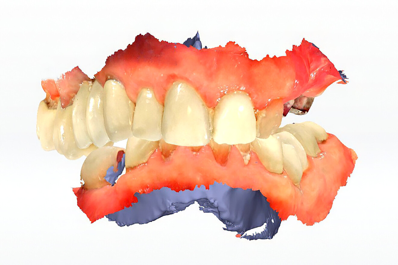 Fig. 3b: Frontal view.